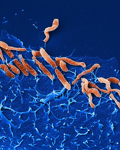 Helicobacter pylori adhäriert an Zellen