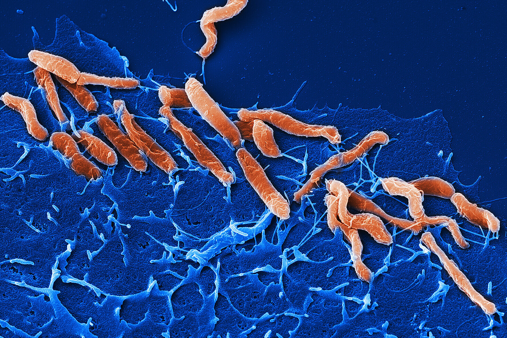 Helicobacter pylori, a pathogen residing in the stomach, is the cause of the most common chronic bacterial infection. ©HZI/Rohde