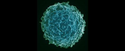 Rasterelektronenmikroskopische Aufnahme einer menschlichen B-Zelle