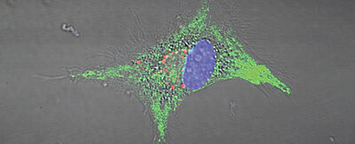 Mikroskopische Aufnahme einer dendritischen Zelle