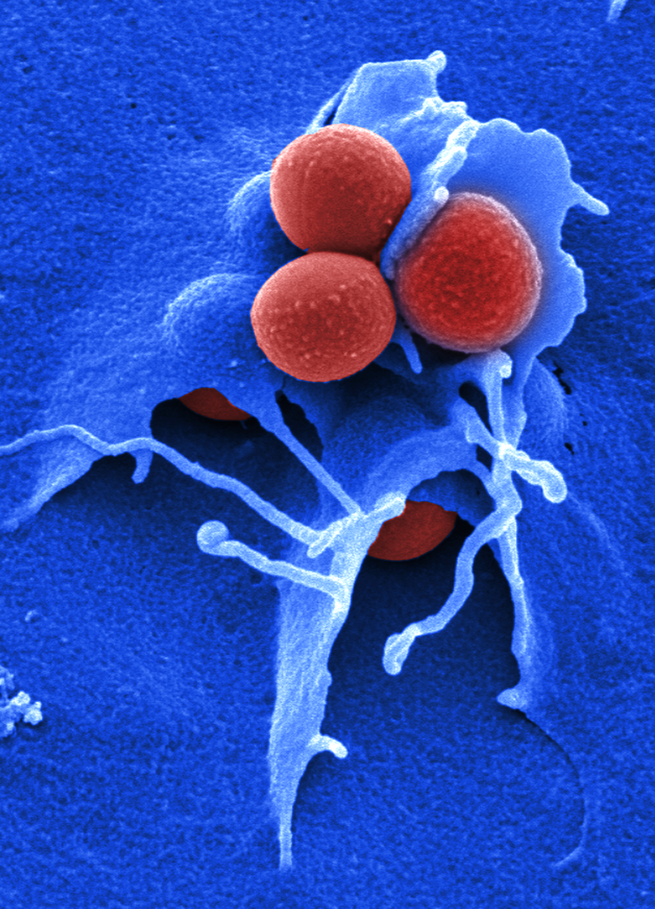 Bakterien der Art Staphylococcus aureus