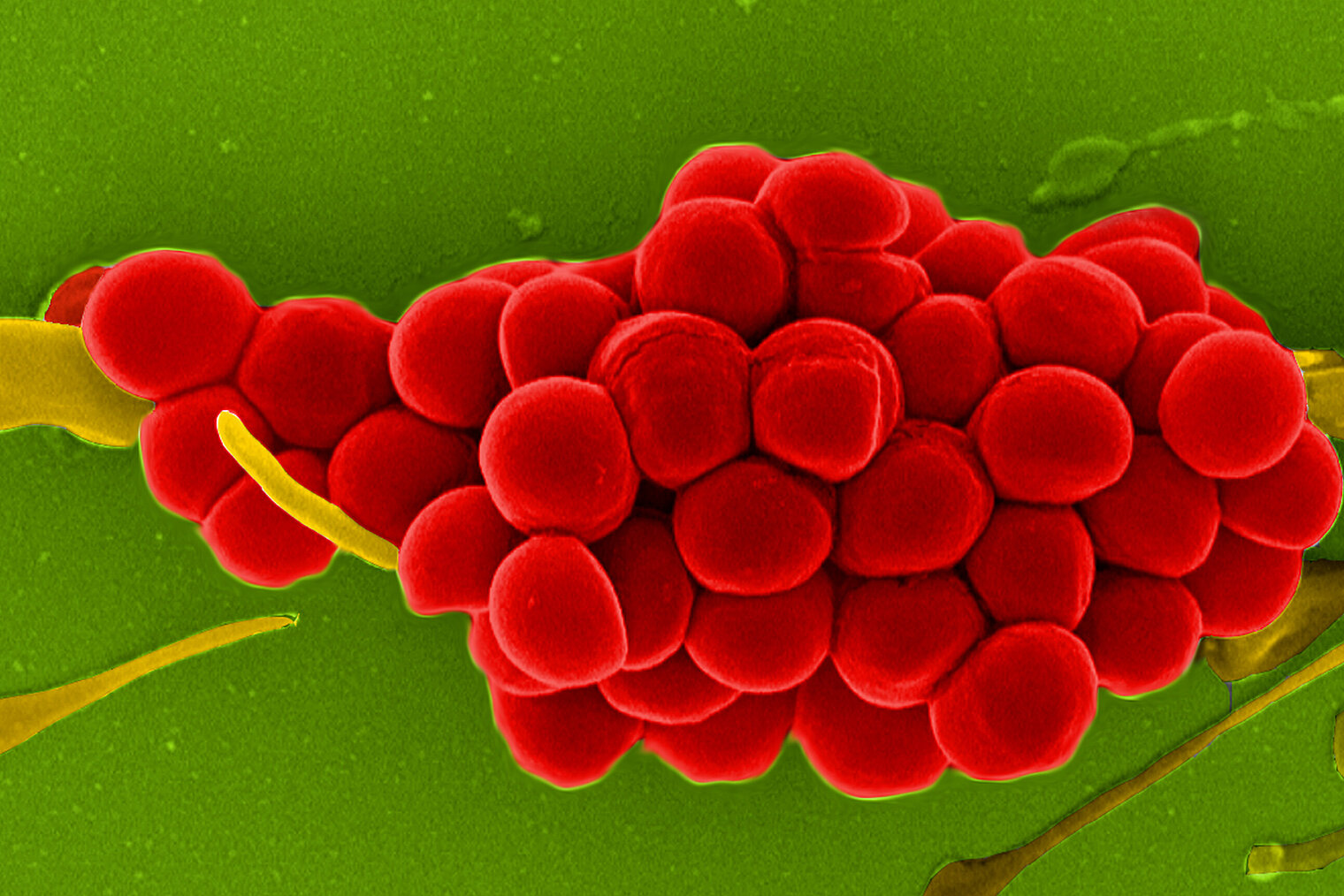 Electron micrograph of S. aureus
