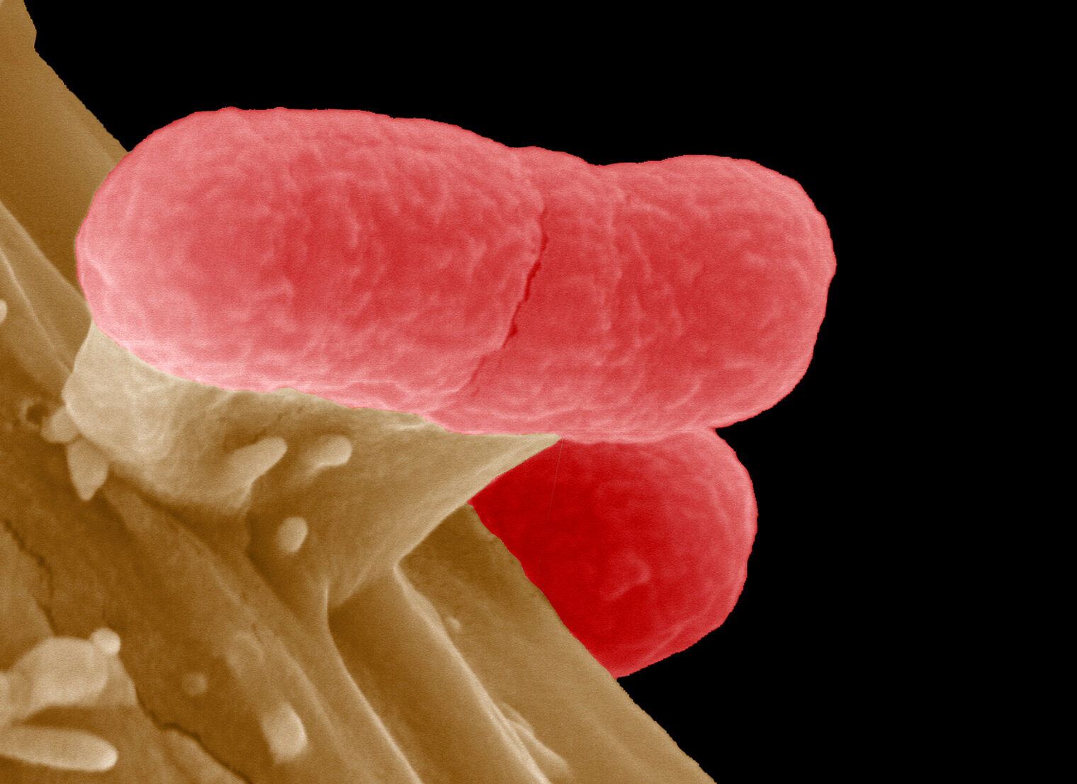 Electron micrograph of EHEC bacteria