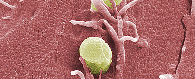 Bakterien der Art Yersinia pseudotuberculosis dringen in menschliches Gewebe ein. 
