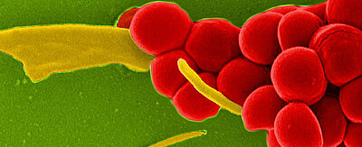 Bakterien der Art Staphylococcus aureus bilden häufig Resistenzen gegen Antibiotika