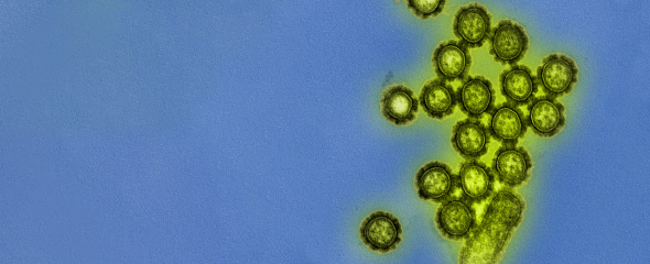 Viruspartikel des Grippeerregers H1N1.