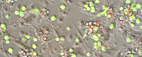 Von Monozyten abgeleitete dendritische Zellen nach einer Infektion mit dem Zytomegalievirus (grün) und dem Schimmelpilz Aspergillus fumigatus (rot). 