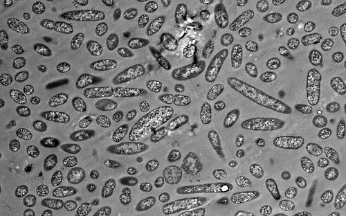 Neue Erkenntnisse zur Vielfalt der Darmmikrobiota
