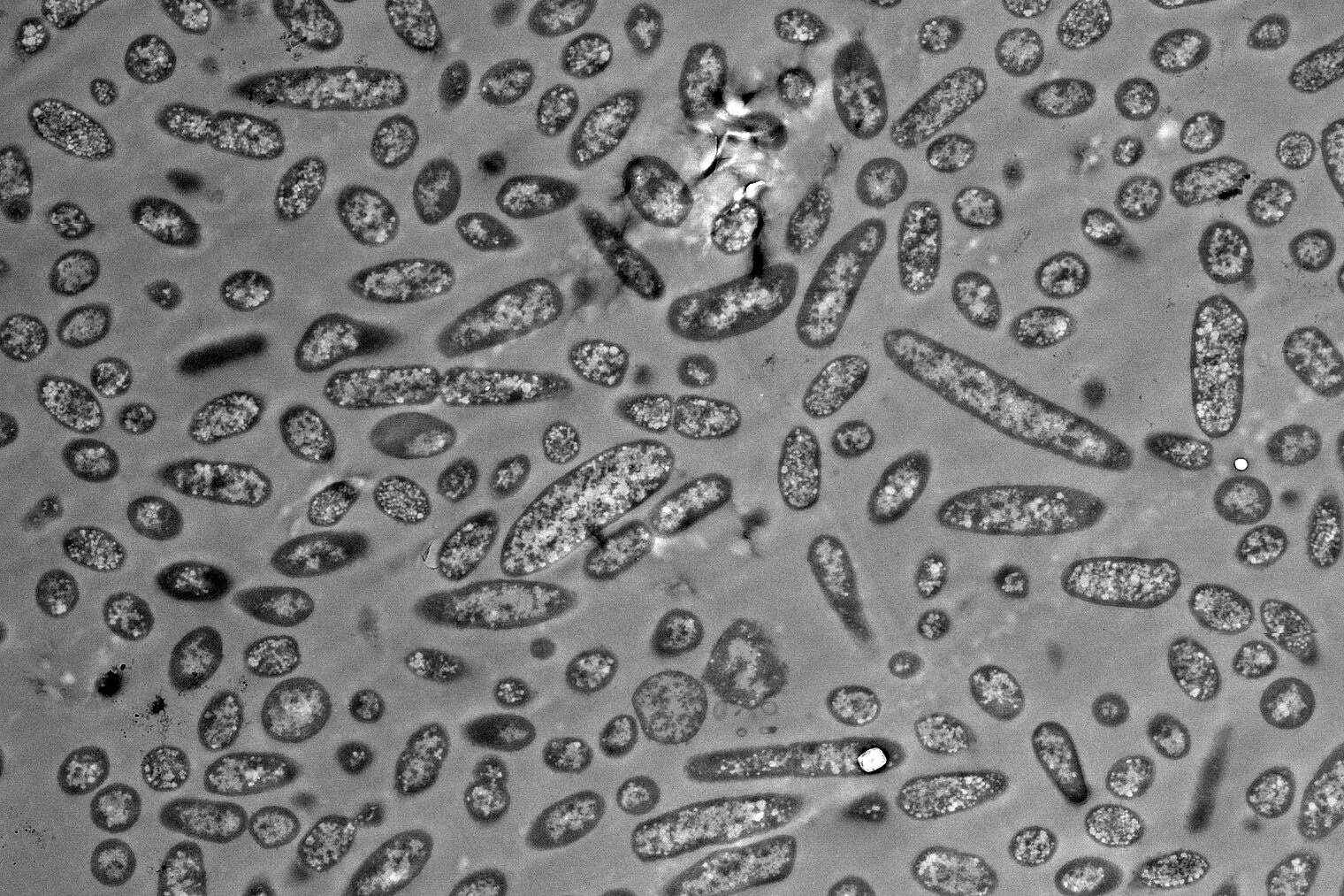 Electron microscope image of Bacteroides thetaiotaomicron, illustrating the differences in the size of the bacterial cells. 