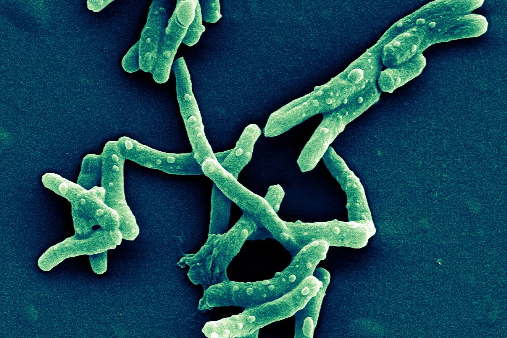 Rasterelektronenmikroskopische Aufnahme von Mycobacterium tuberculosis 