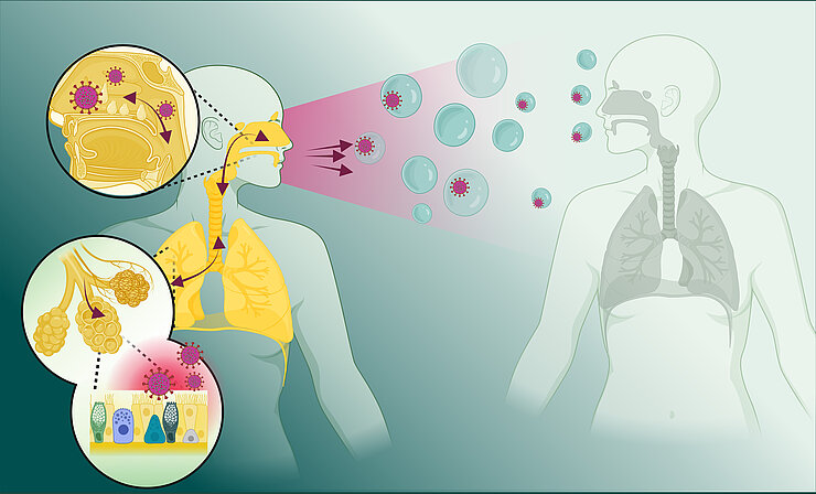 Illustration der Übertragen von Atemwegserregern