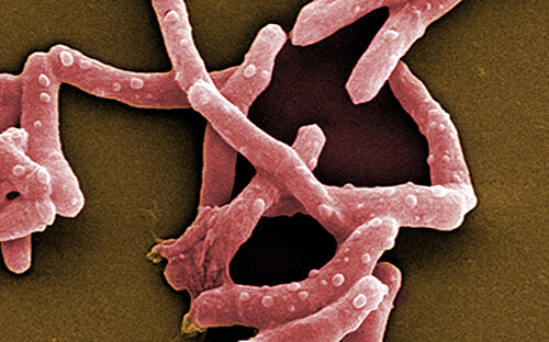 Rasterelektronenmikroskopische Aufnahme von Mycobacterium tuberculosis