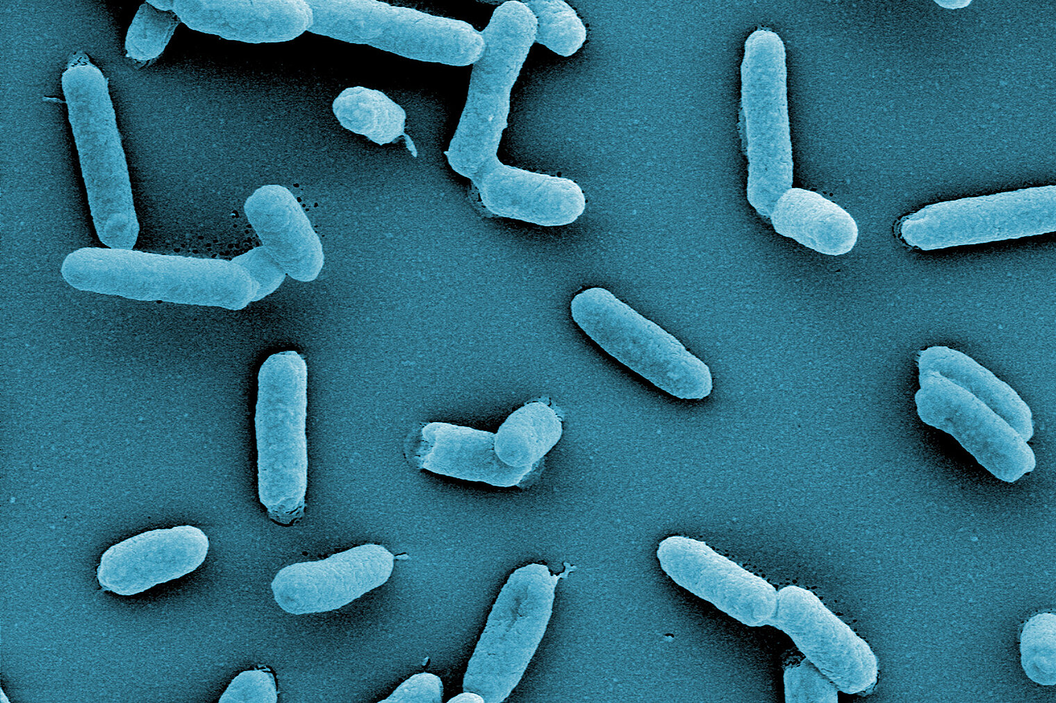 Salmonella under the microscope
