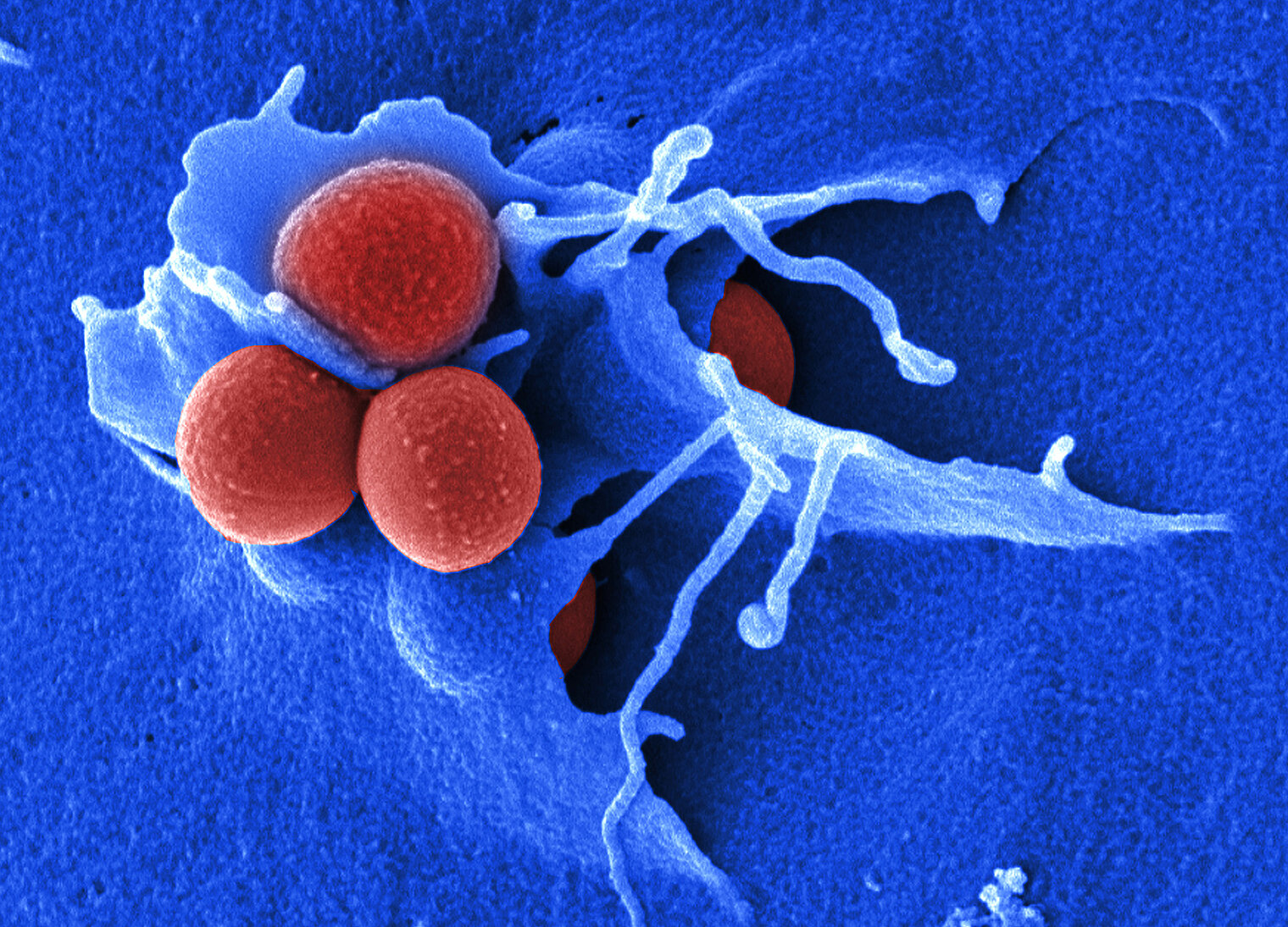 Invasion of MRSA in epithelial cells.