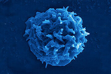 Elektronenmikroskopische Aufnahme einer T-Zelle