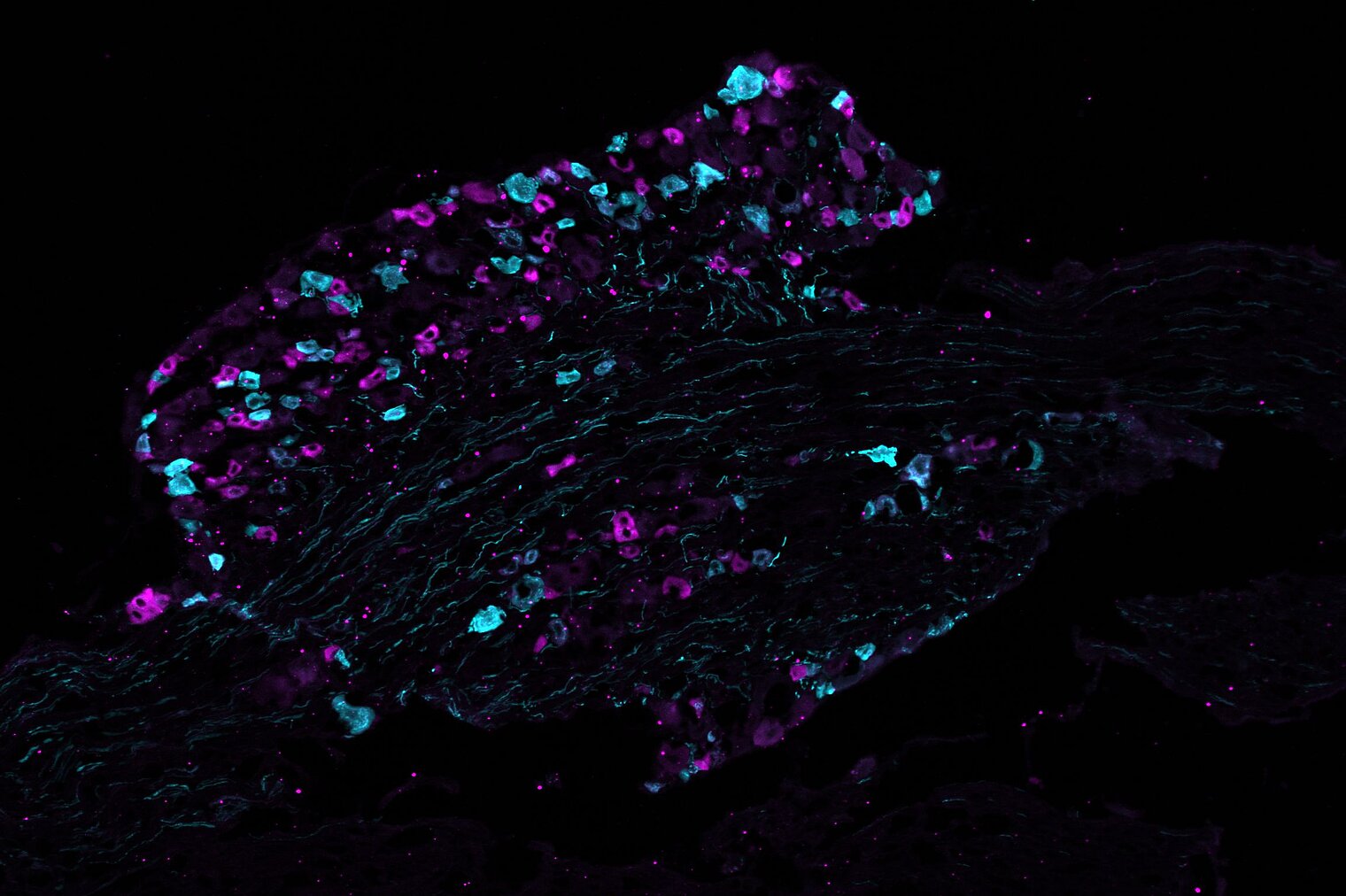Schnitt durch ein Spinalganglion einer Maus, in dem zwei unterschiedliche Typen von Schmerzrezeptoren in Cyan (türkis) und Magenta (pink) angefärbt sind.