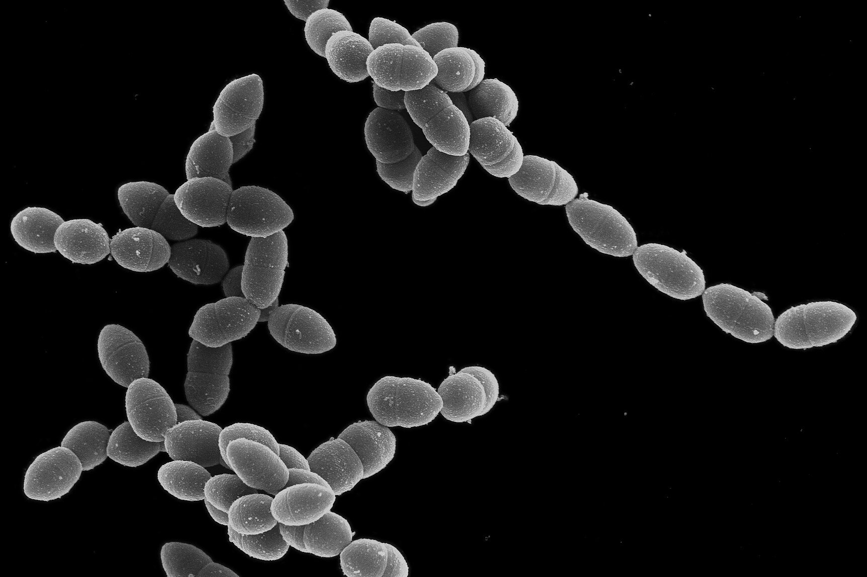 Electron micrograph of coccal bacteria growing in chains