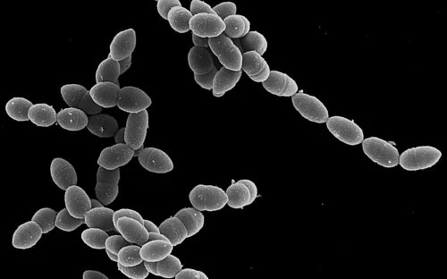 Long-term effects of influenza A virus infections on lung cells and their response to pneumococci