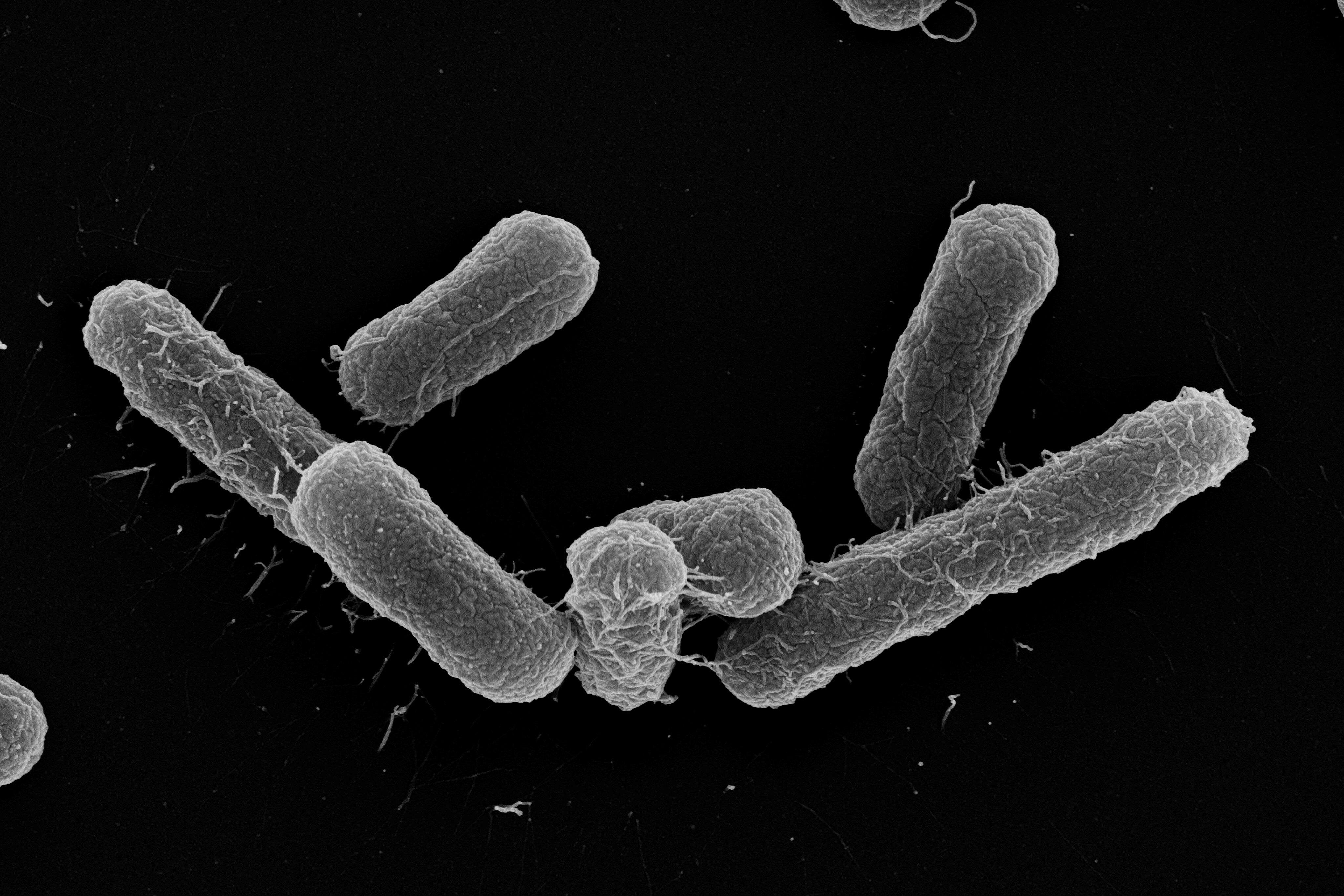 Electron microscope image