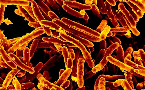 Neue S3-Leitlinie zur Prävention von Tuberkulose bei neu zugewanderten Menschen veröffentlicht