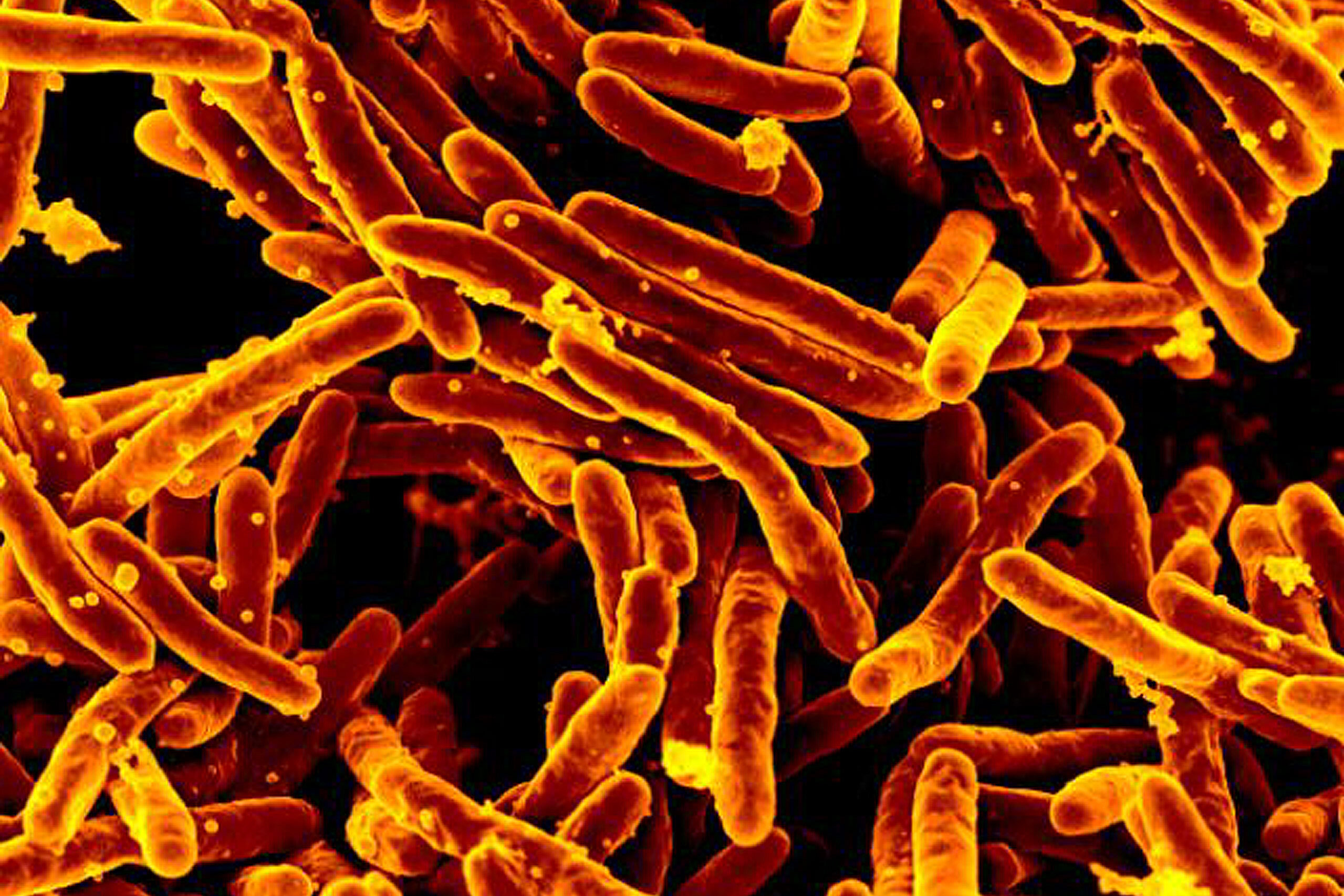 Image of yellow-gold rod-shaped bacteria