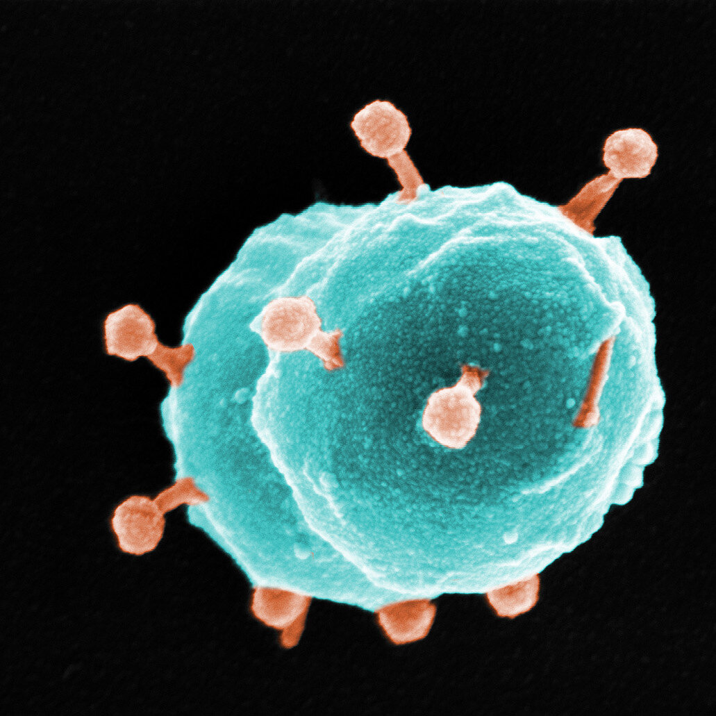 Enterococcus faecium-Zelle die von Bakteriophagen infiziert wird.