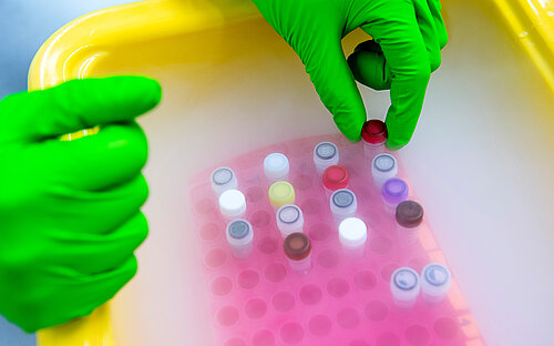Samples on dry ice.