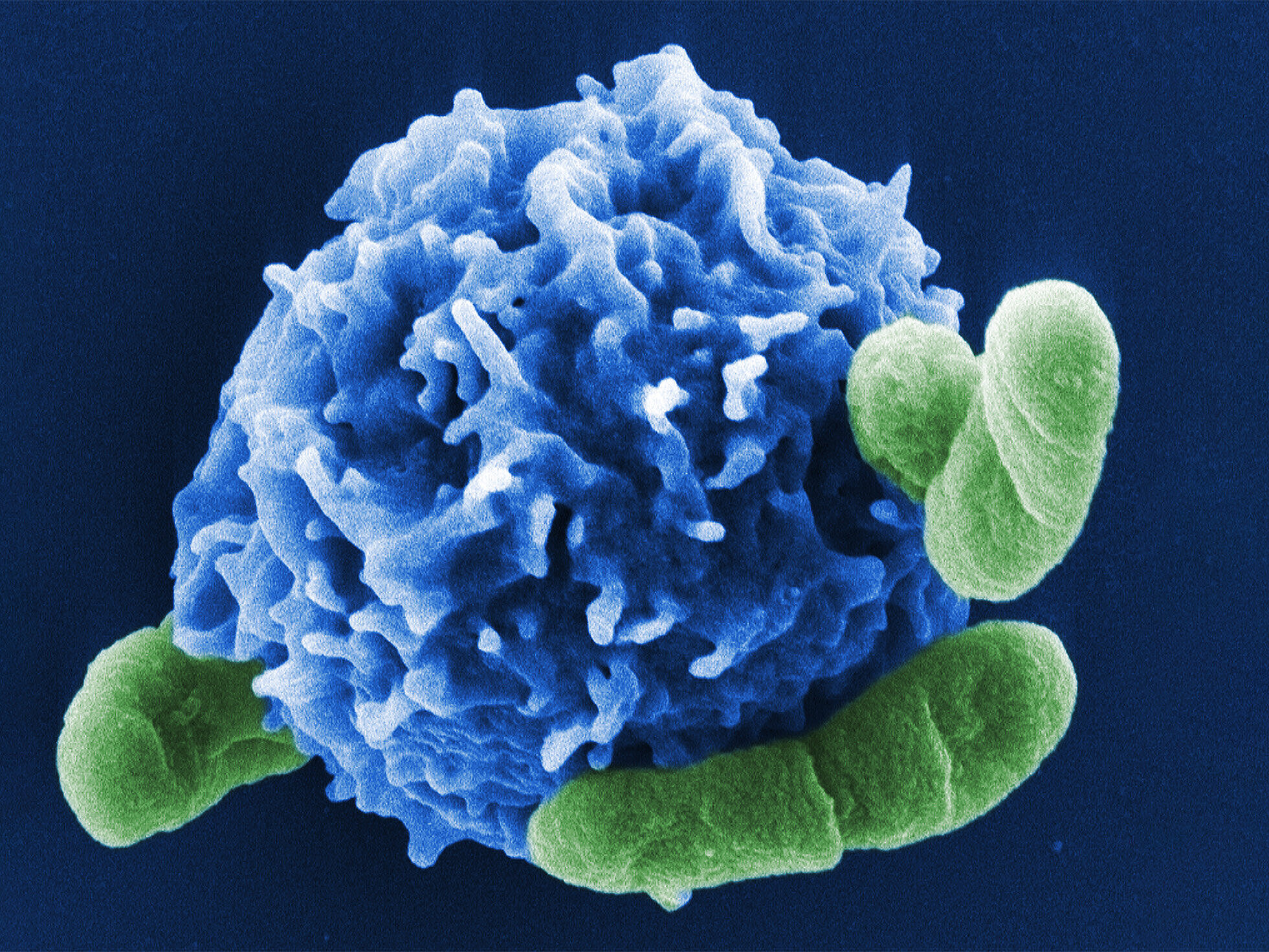 Bacteria adhering to regulatory T cell.