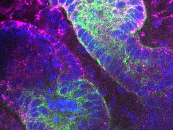 Host condensates in kidney organoids. 
