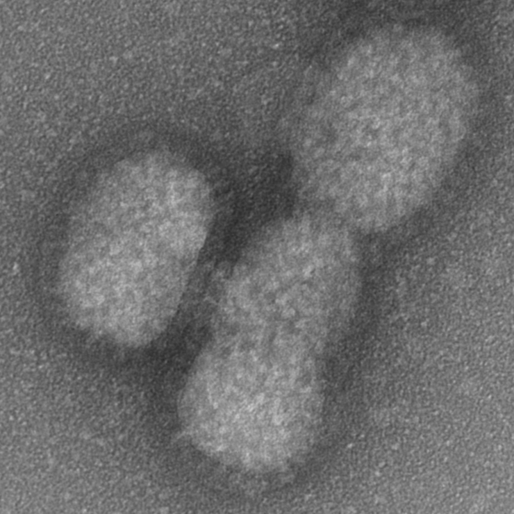 Black-white image of viral particles