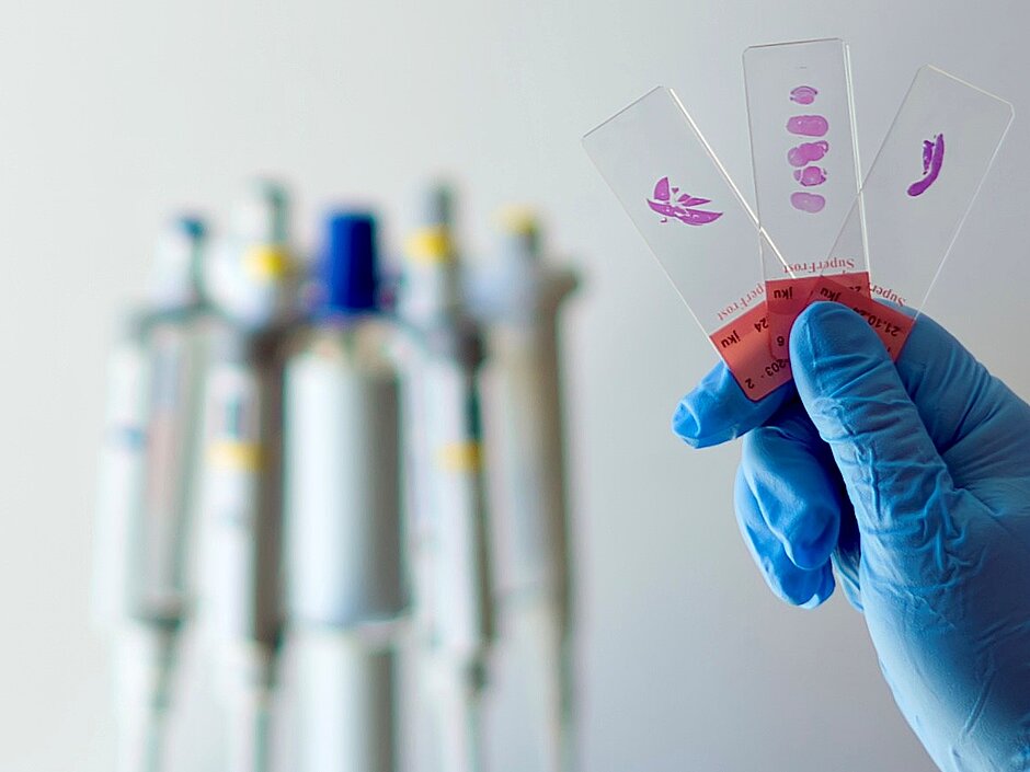 Microscopy slides