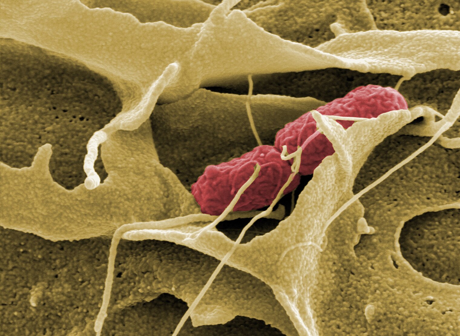 Salmonellen sekretieren Giftstoffe in umliegende Darmzellen, die dadurch die Membran ausstülpen.