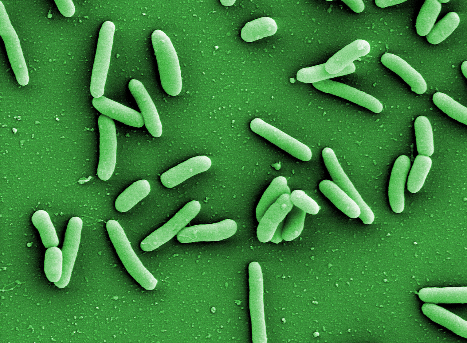  Pseudomonas aeruginosa 