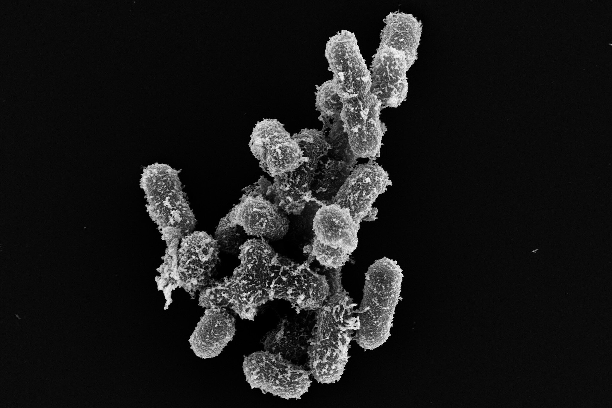 Elektronenmikroskopische Aufnahme von Klebsiella oxytoca
