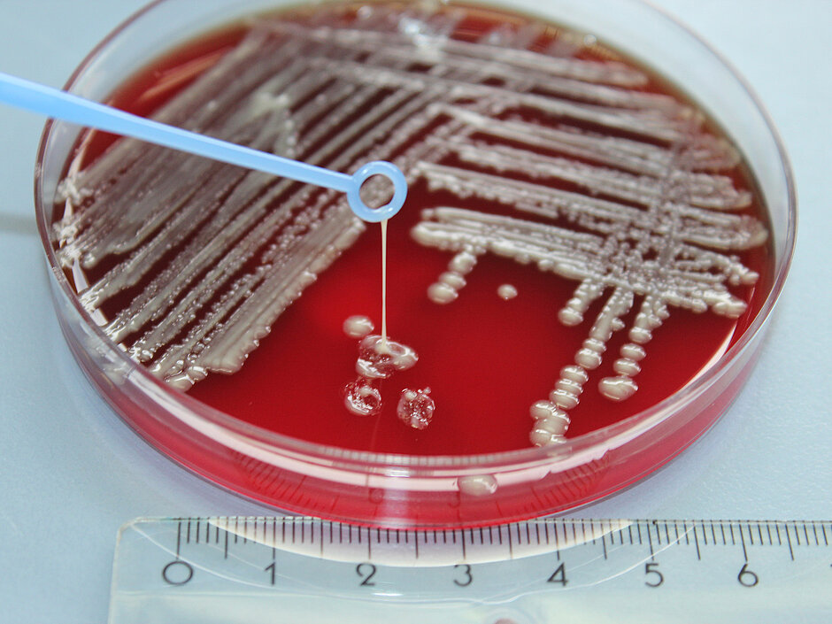 Bacteria on an agar plate (red) and a blue swab (string test) 