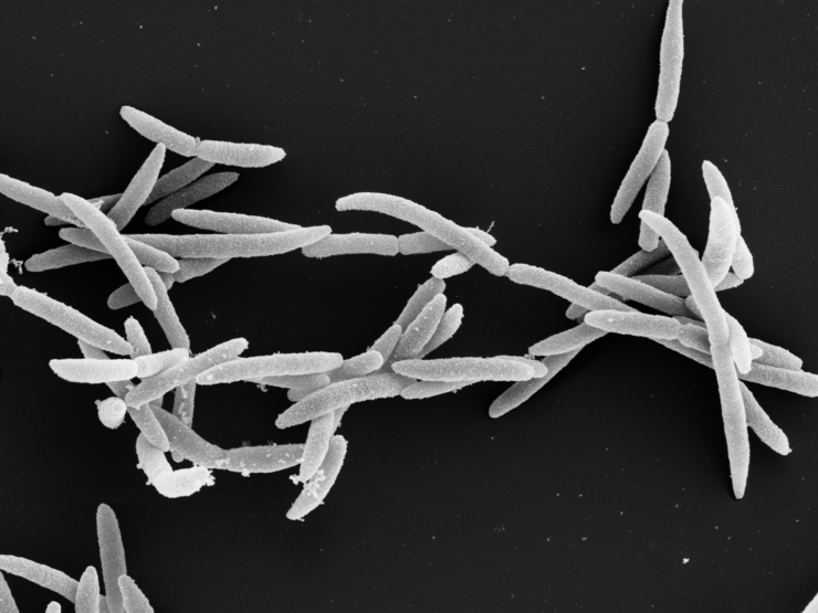 Elektronenmikroskopieaufnahme von Fusobakterien, längliche schwarz-weiße Bakterien