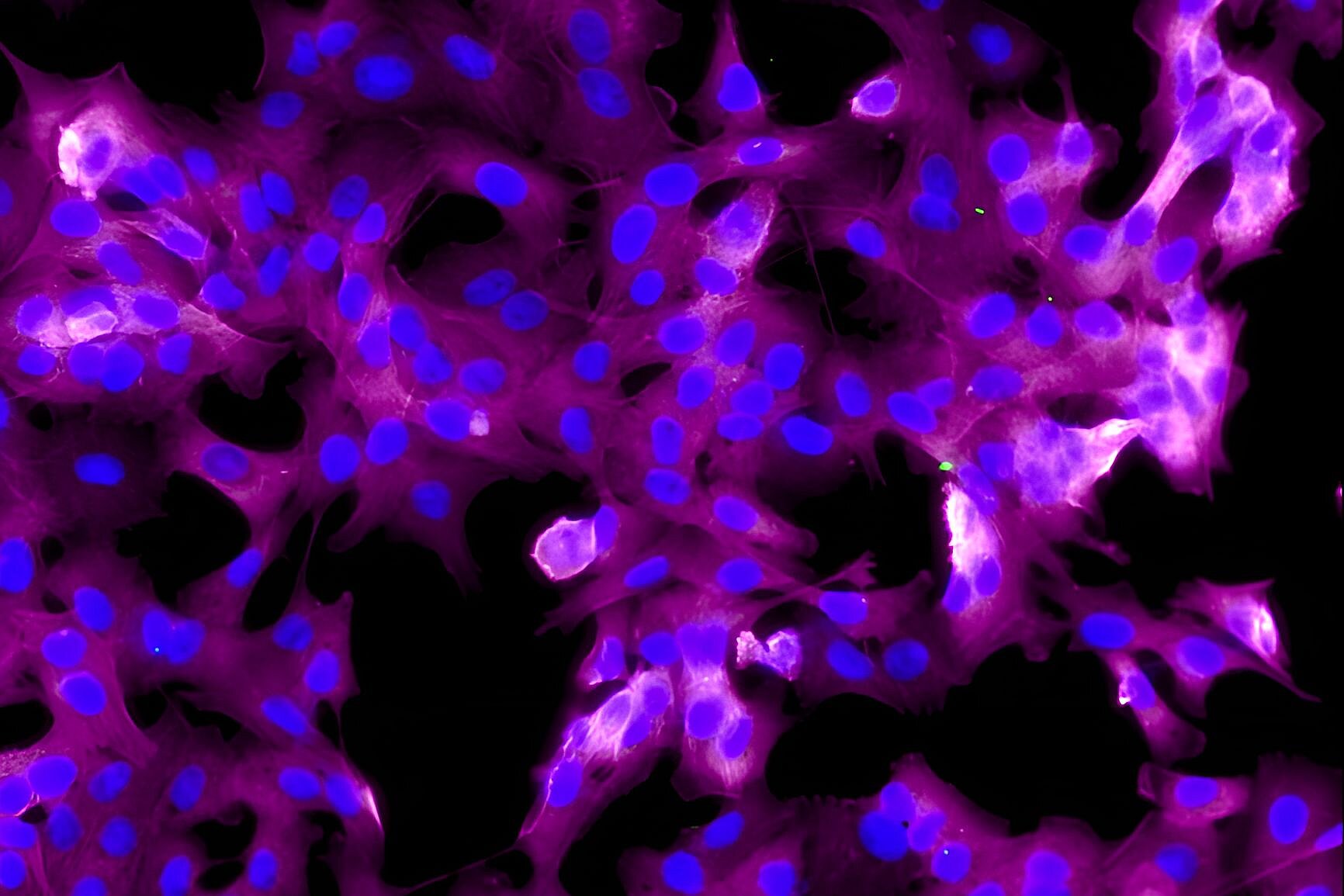 Fluoreszenzmikroskopie von Zellen in magenta und blau