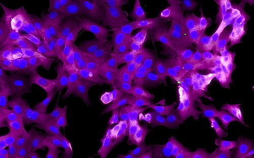 Fluoreszenzmikroskopie von Zellen in magenta und blau