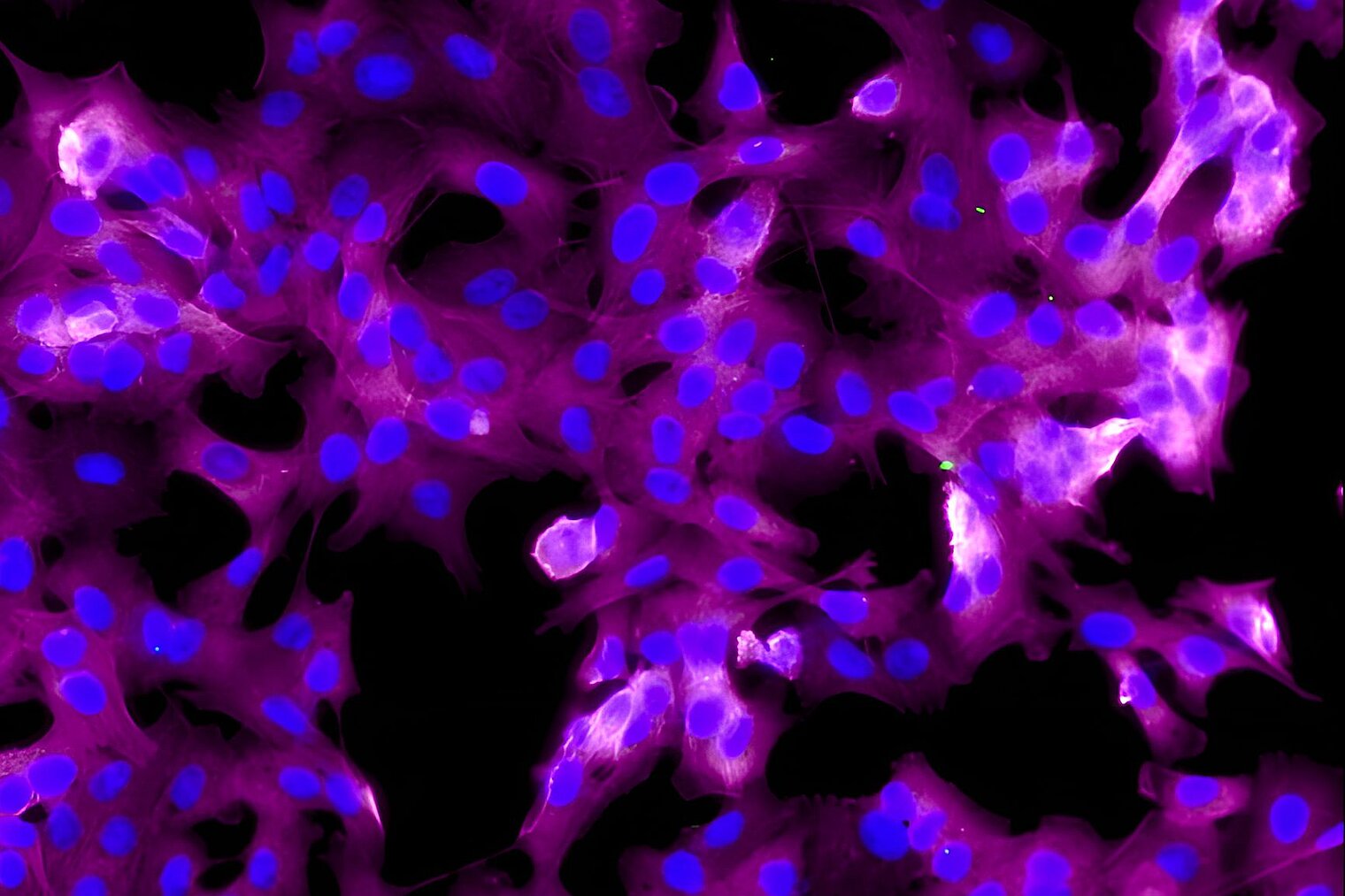 Fluoreszenzmikroskopie von Zellen in magenta und blau