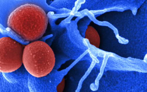 Elektronenmikroskopische Aufnahme von Staphylococcus aureus
