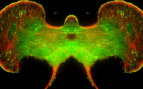 How cells move – and how they regulate this