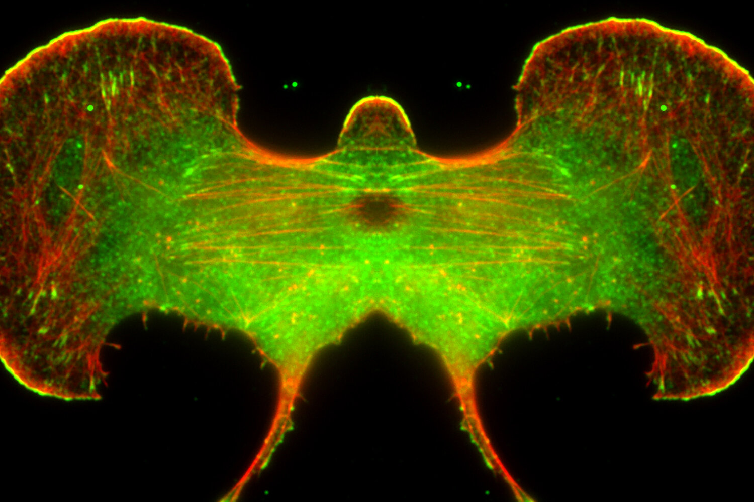  Melanoma cell on a black background