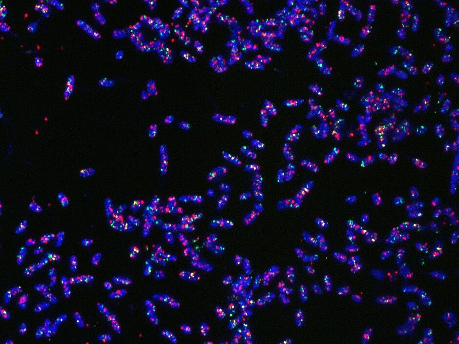 Stained cells of Bacteroides thetaiotaomicron