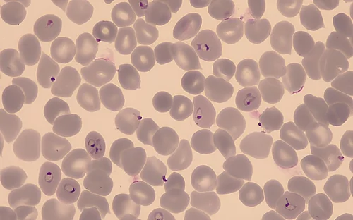 New compound cuts off protein supply to parasites