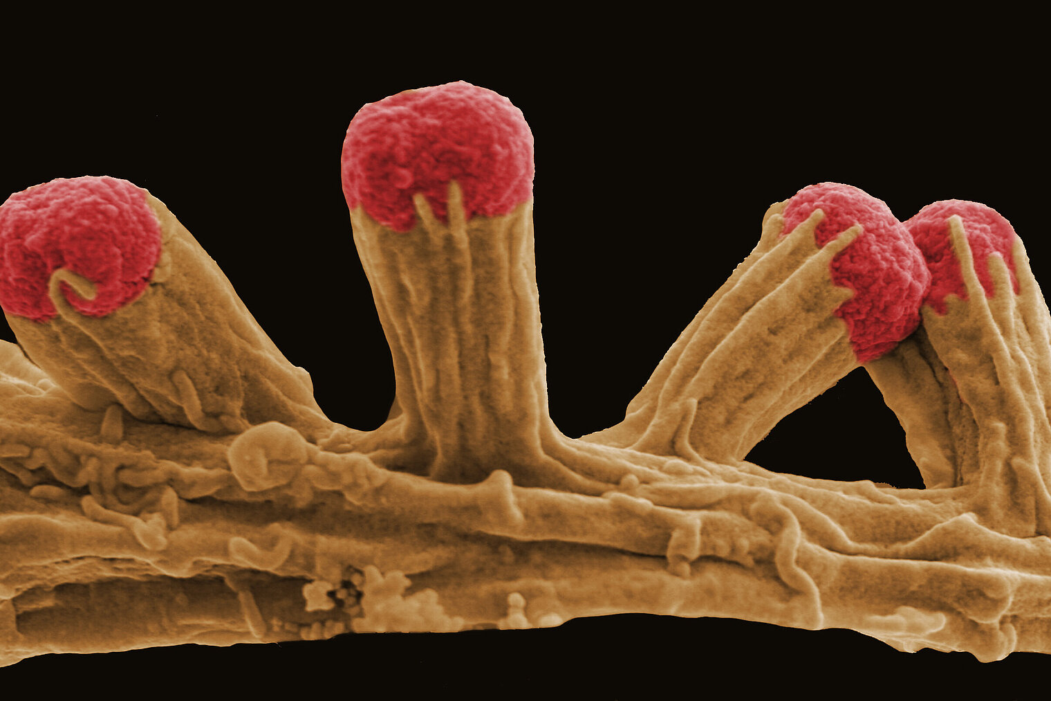 Electron micrograph of E. coli