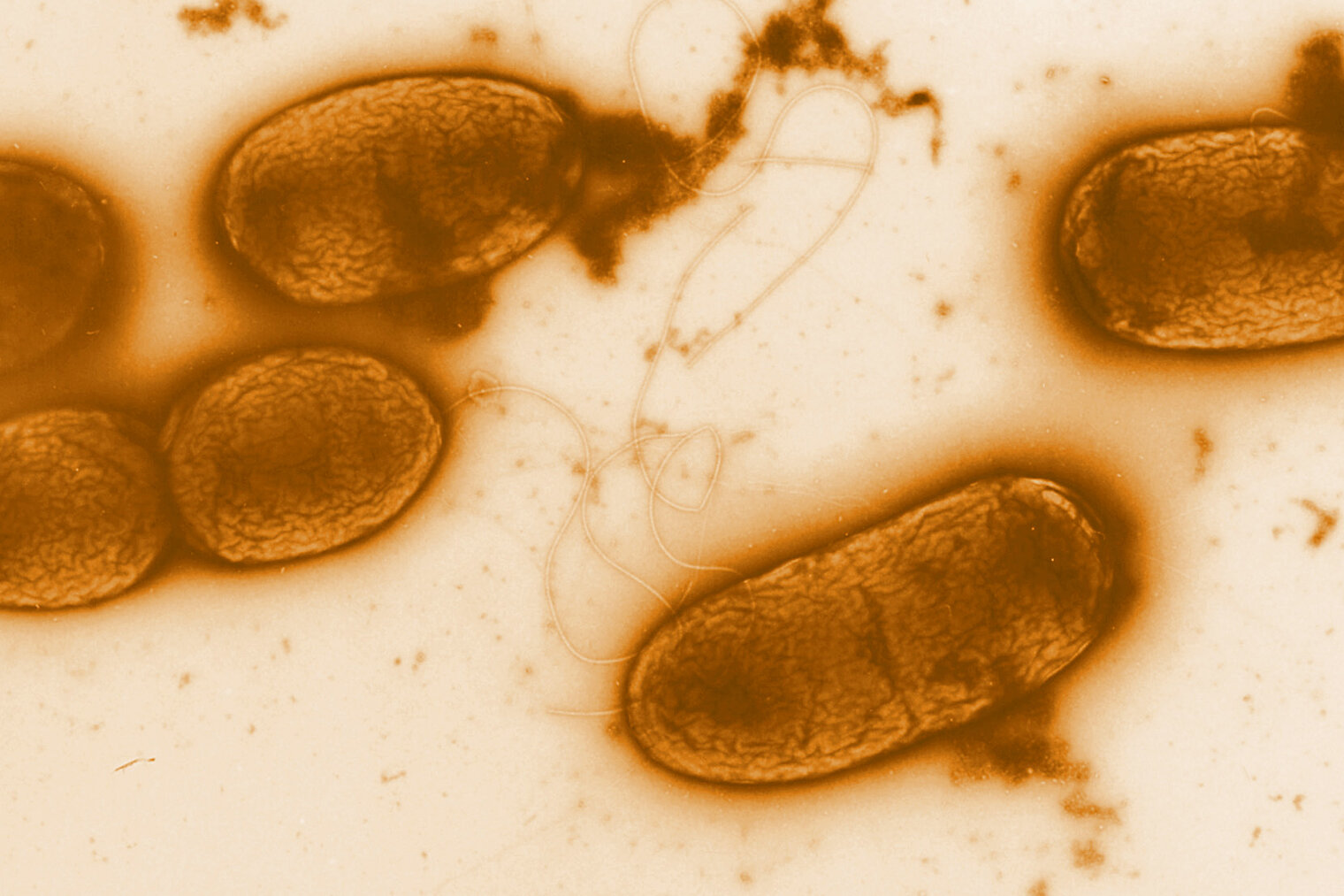 Electron micrograph