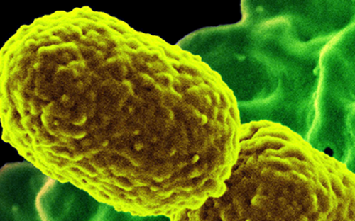 Raserelektronenmikroskopische Aufnahme von Klebsiella pneumoniae 