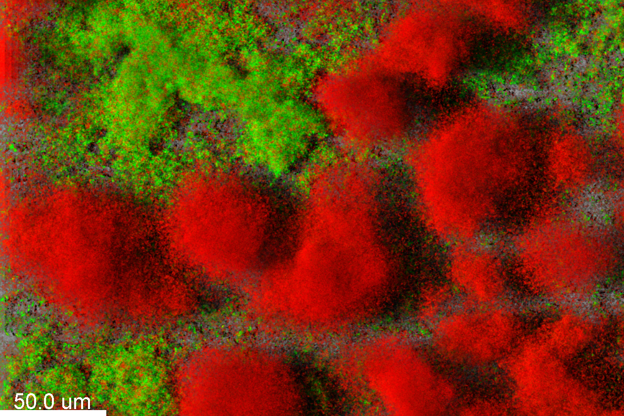 Pseudomonas aeruginosa 