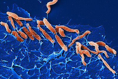 Helicobacter pylori, ein im Magen ansässiger Erreger, ist die Ursache der häufigsten chronischen bakteriellen Infektion. ©HZI/Rohde