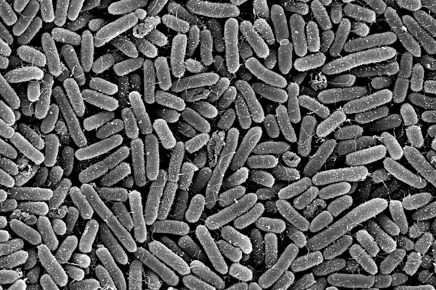 Electron micrograph of Pseudomonas aeruginosa